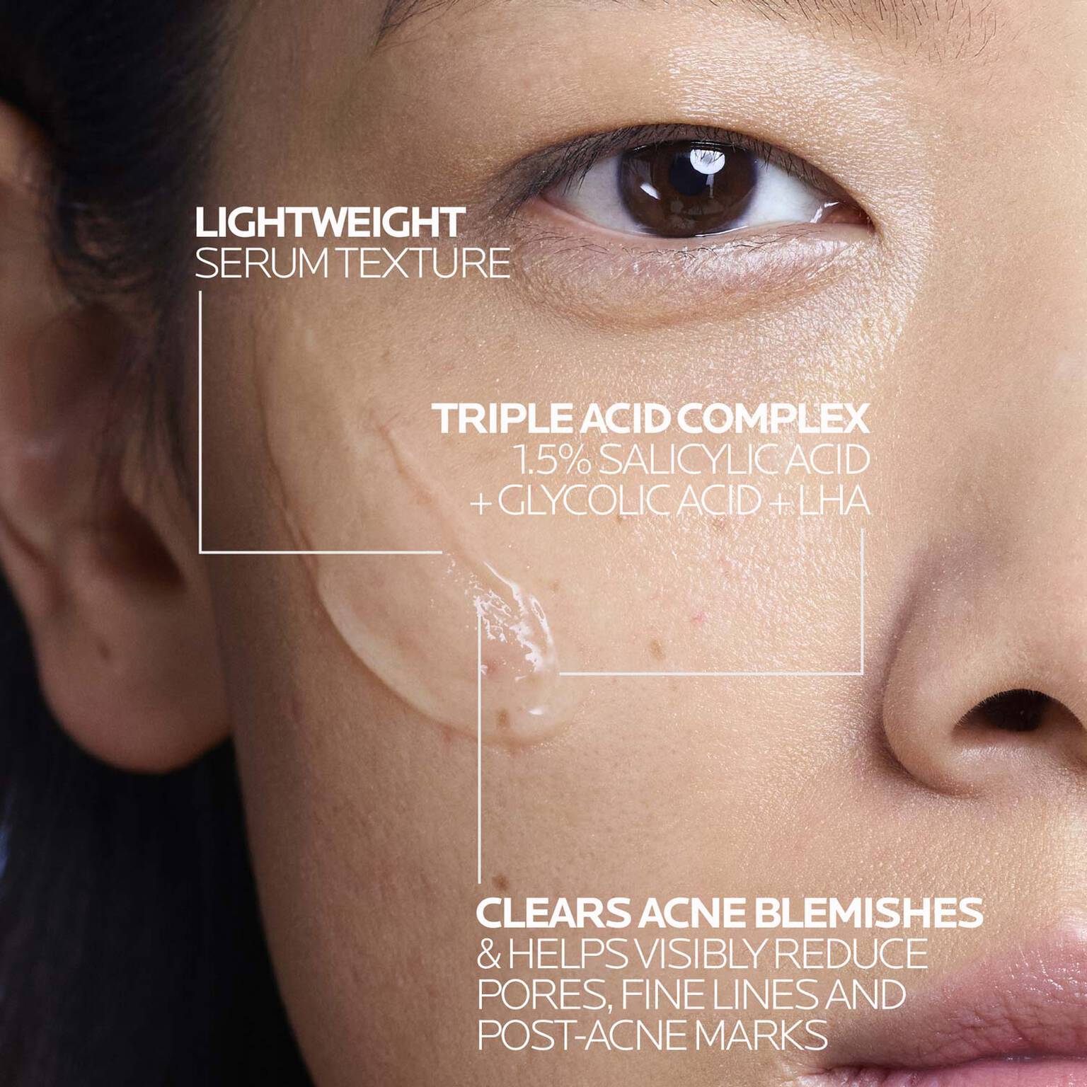 effaclar-salicylic-acid-acne-treatment-serum-k5 LaRochePosay-Product-Effaclar-Effaclar-Serum-30ml-3337875722827-Texture-REV.jpg