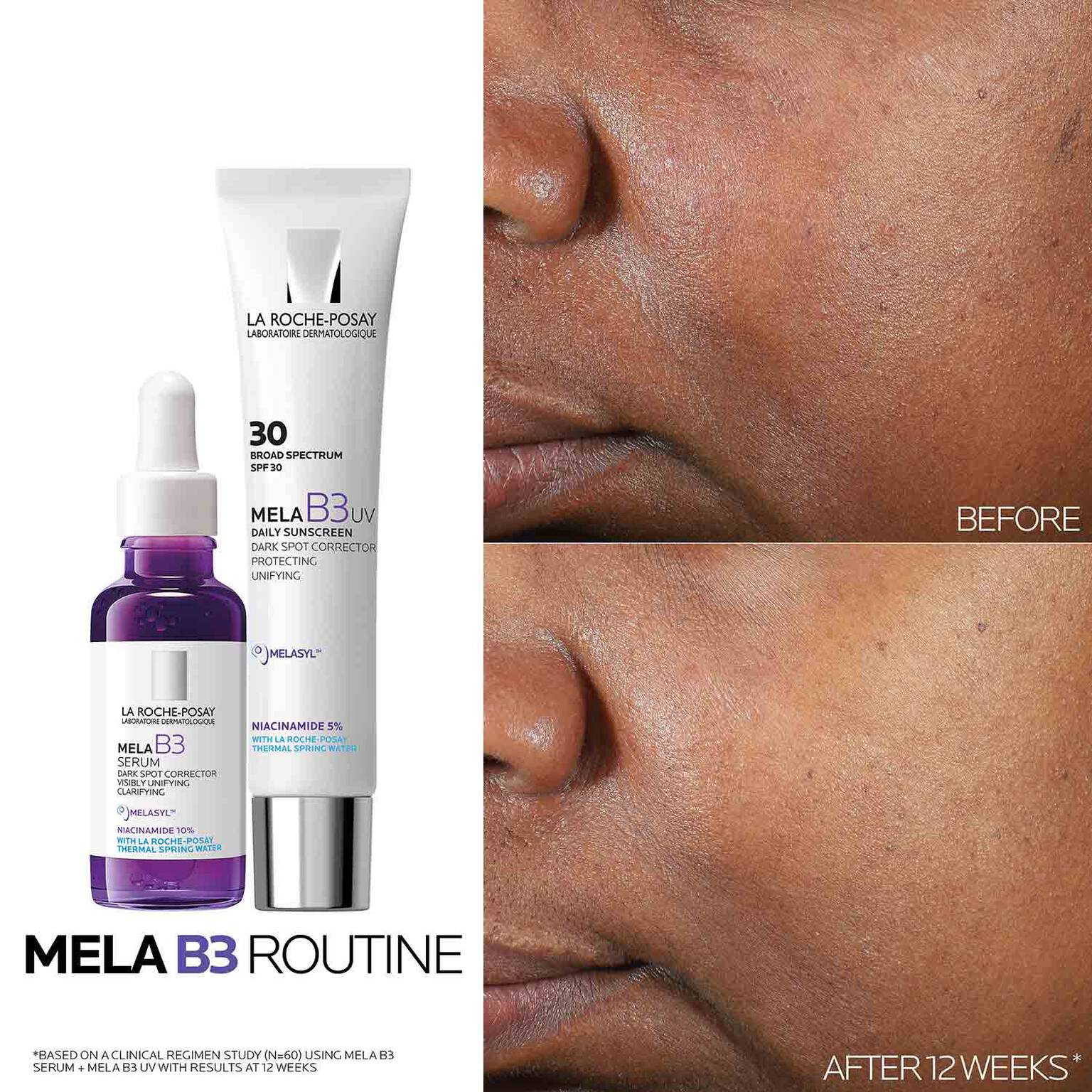 mela-b3-dark-spot-serum-with-melasyltm-niacinamide-o4 Mela-B3-routine_1500X1500.jpg