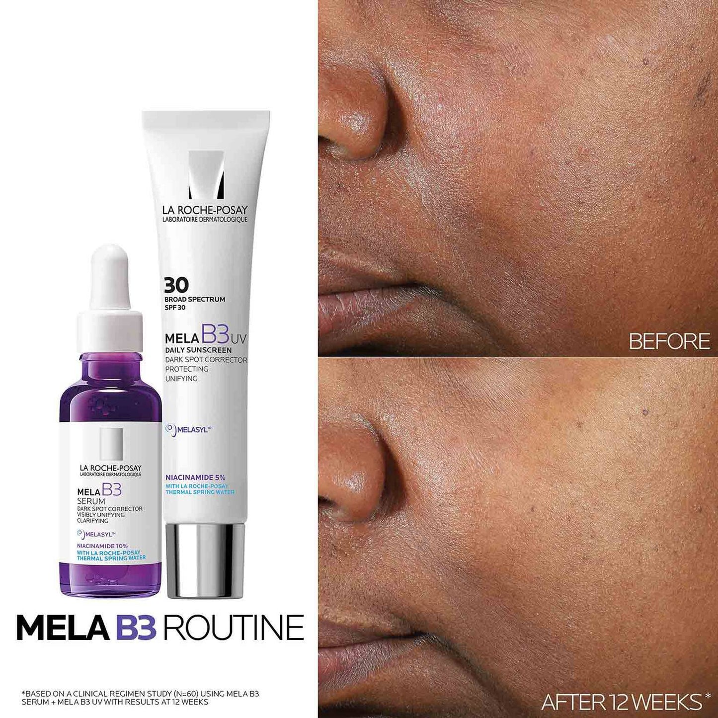 mela-b3-uv-daily-moisturizer-spf-30-with-melasyltm-niacinamide-e8 Mela-B3-routine_1500X1500.jpg