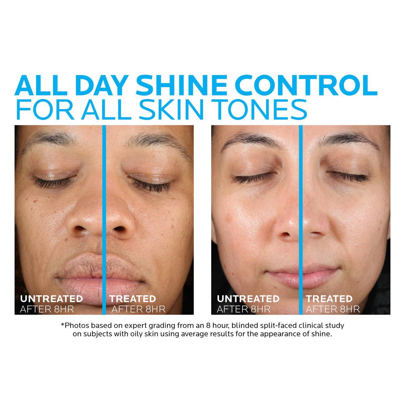 toleriane-double-repair-matte-face-moisturizer-for-oily-skin-q5 la-roche-posay-toleriane-matte-moisturizer-before-and-after-pdp-alt.jpg